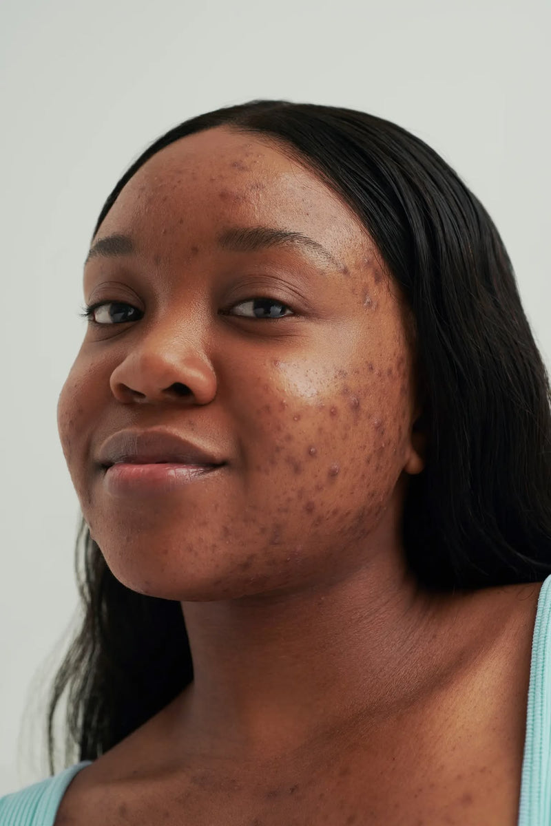 Calm breakouts